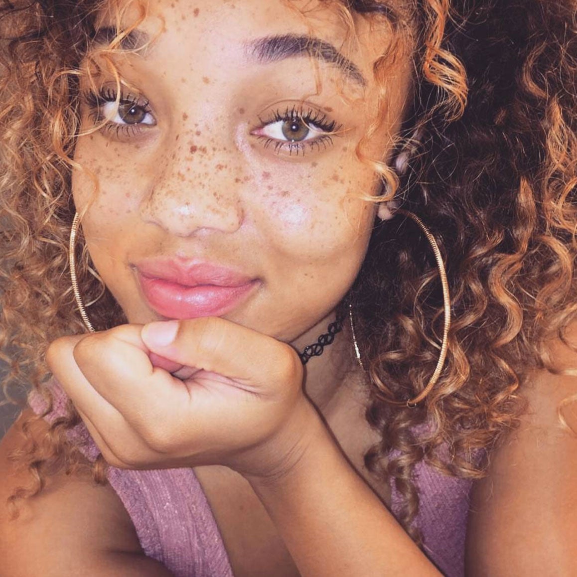 1158px x 1158px - Beautiful Black Women With Freckles - Essence