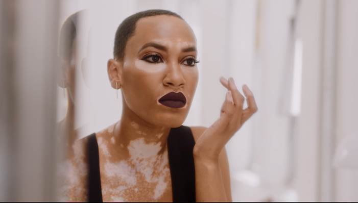 Covergirl Taps Amy Deanna As Their Latest Model And The First With Vitiligo Sitename Essence 9020