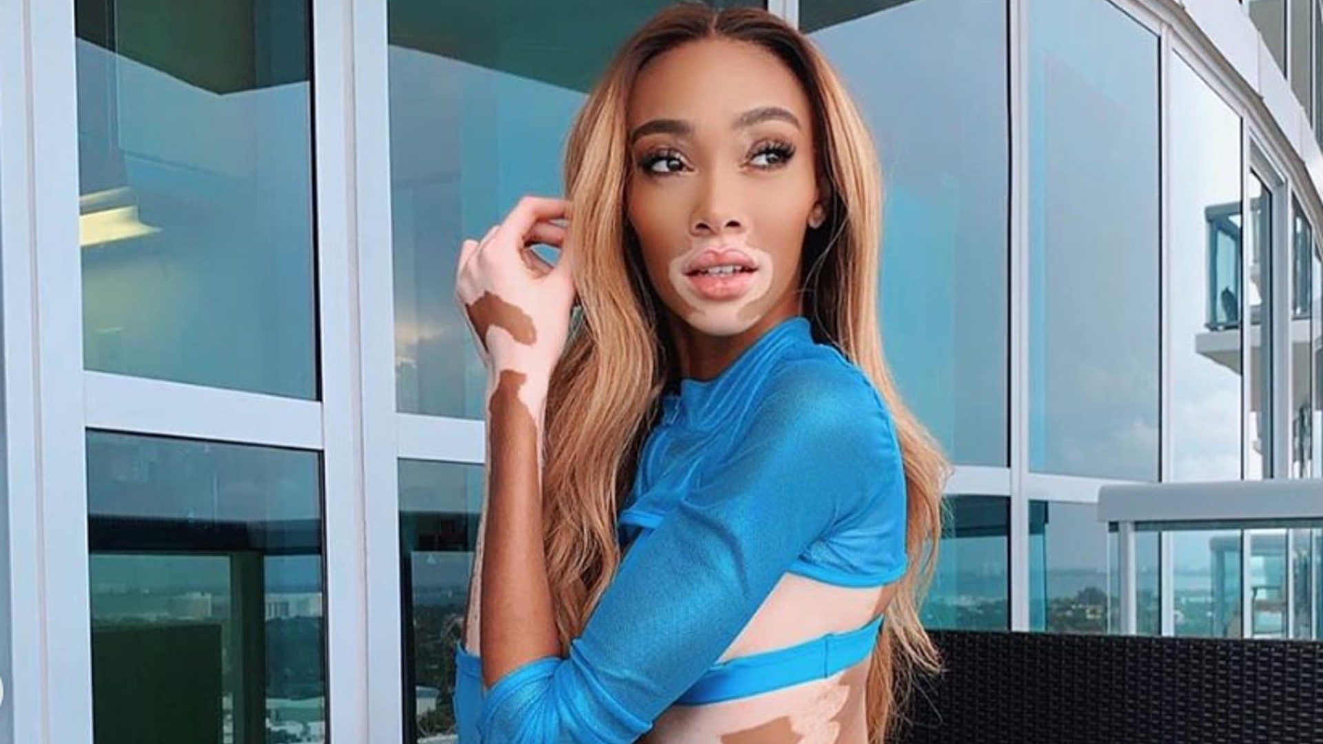 Winnie Harlow's Body Looks Like A Work Of Art In Bikini Photos