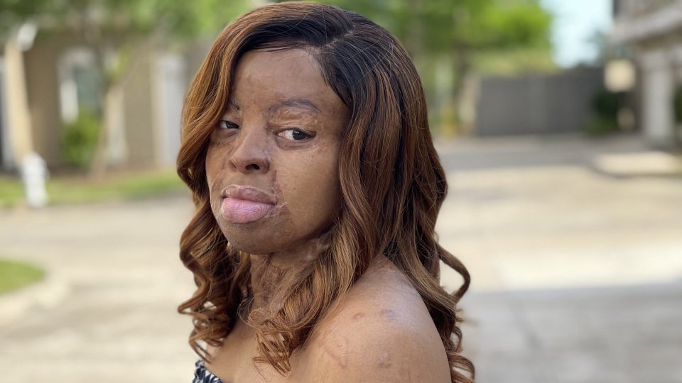 Kechi Okwuchi Talks Survival, Singing, And Self-Love For Face Equality Month