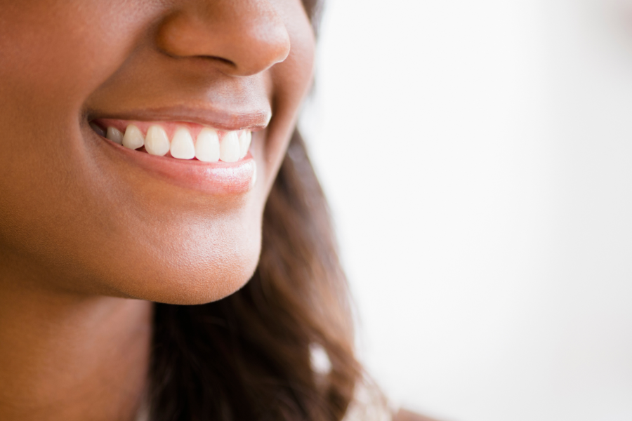 All The Best Teeth Whitening Treatments On Amazon - Essence