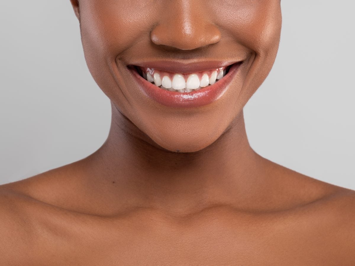 The Best Teeth Whitening Kits For A Brighter Smile