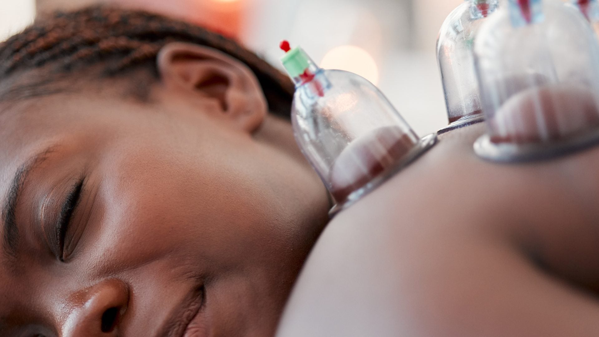 I Tried Cupping Therapy – Here's How It Went