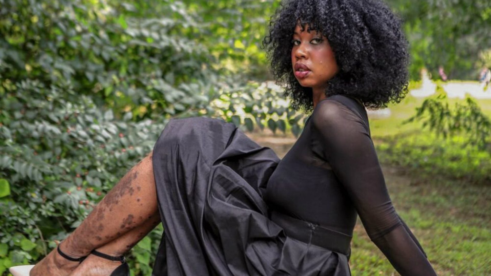 Living with Plaque Psoriasis as a Black Woman Isn’t Easy: Alisha Bridges Won’t Let the Disease Define Her