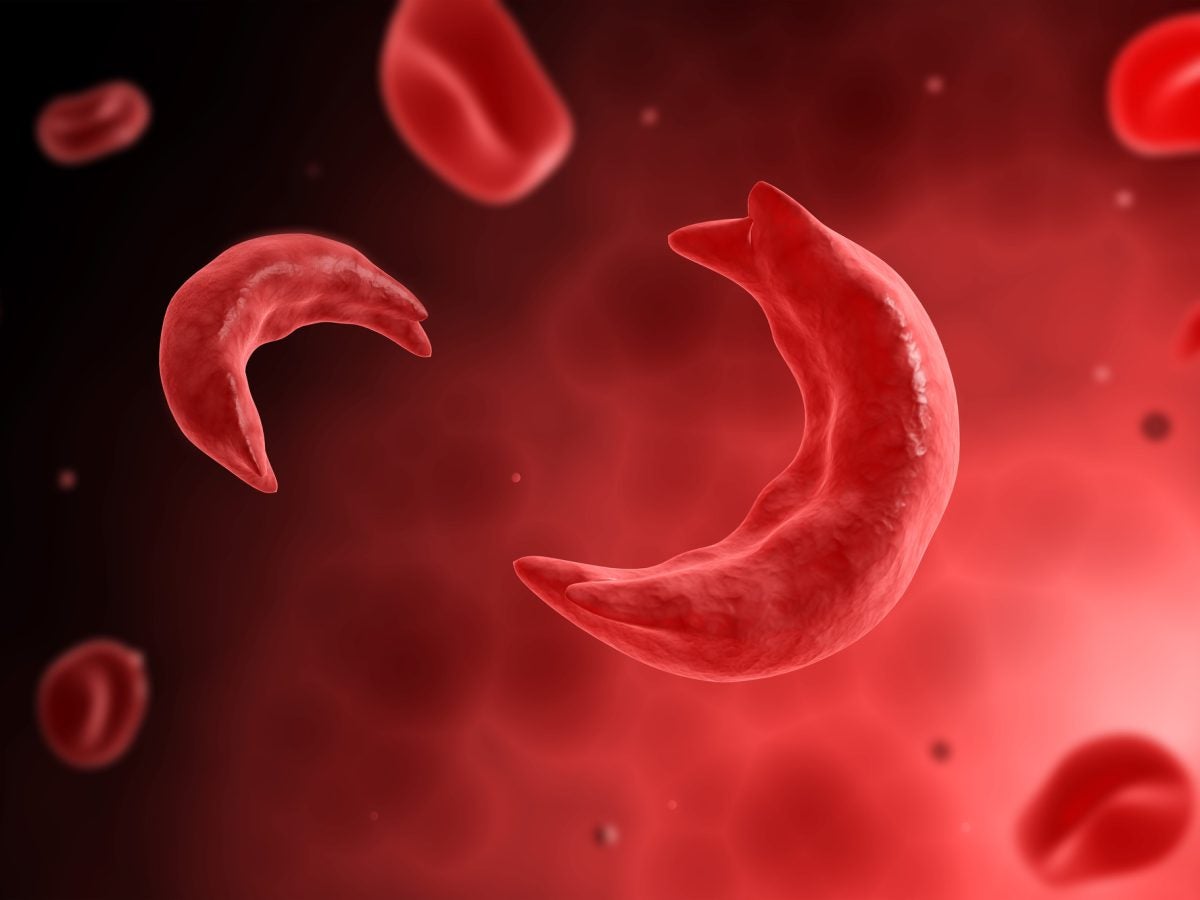 Health Matters: FDA Approves Groundbreaking Gene-Editing Tool That Could Cure Sickle Cell Disease