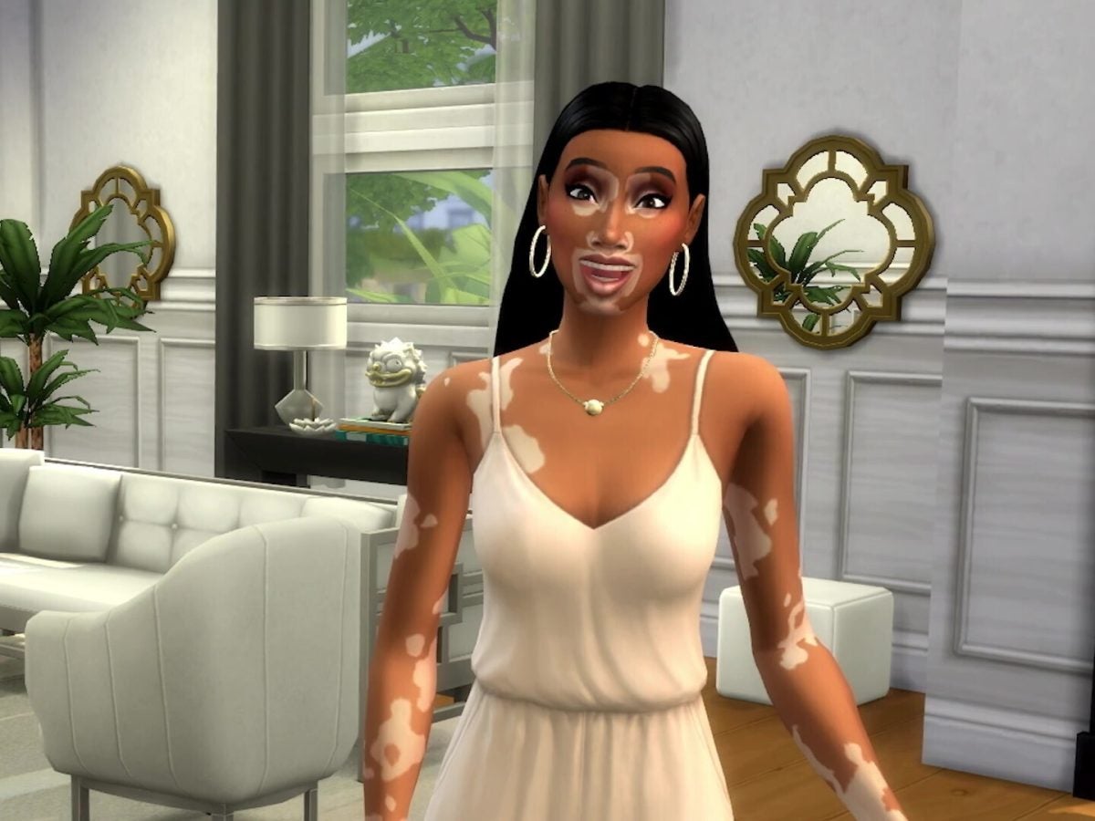 A Vitiligo Skin Feature Is Coming To The Latest 'Sims' Game With Help From Winnie Harlow