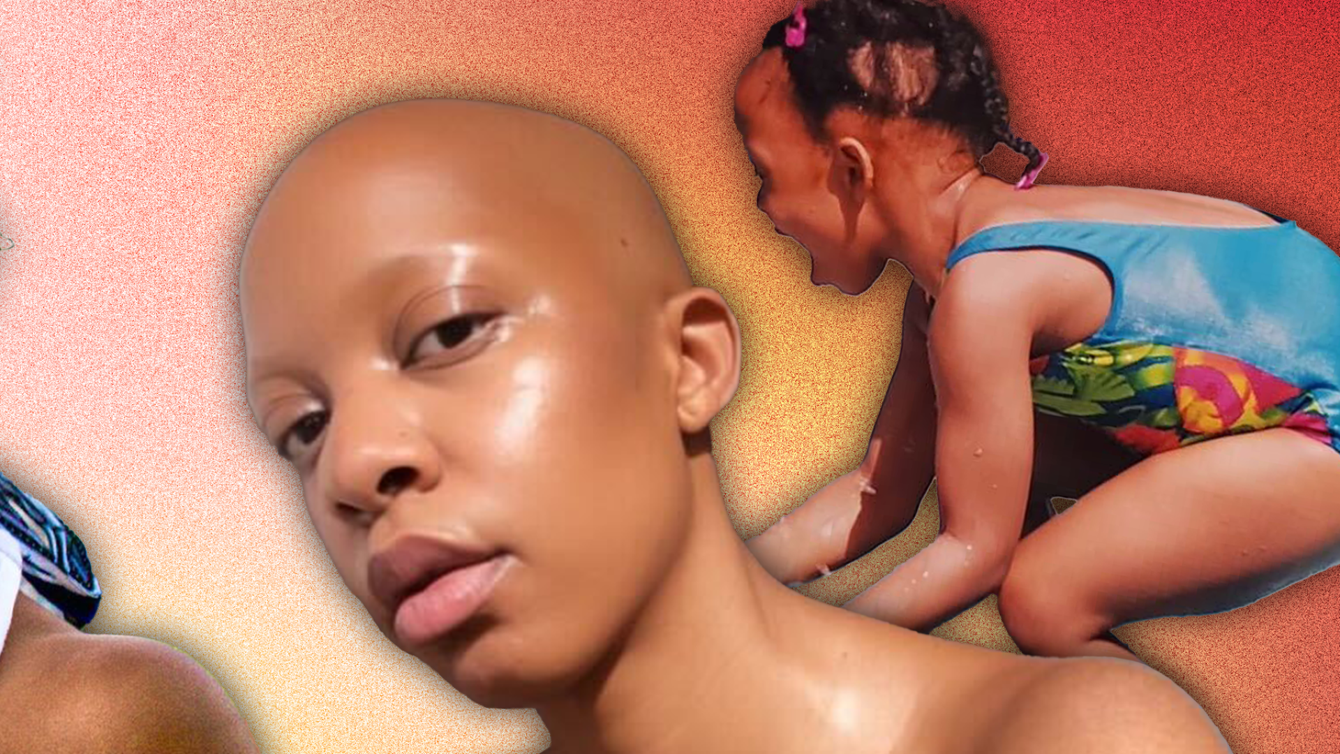 Artfully Bald: Detangling The Beauty Of Black Women With Alopecia