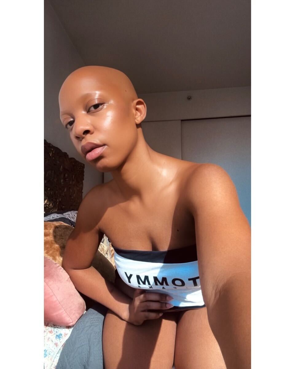 Detangling The Beauty Of Black Women With Alopecia